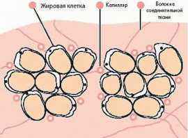 Целюлит, алоэ, алое вера, лечение целюлита