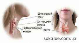 Гипопаратиреоз