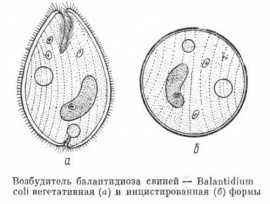 балантидиаз